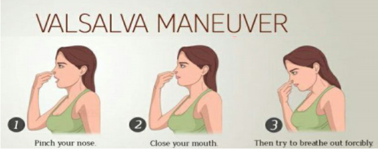valsalva